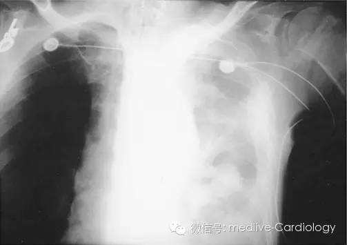 点击查看原图 图片