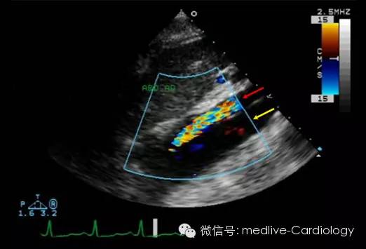 点击查看原图 图片