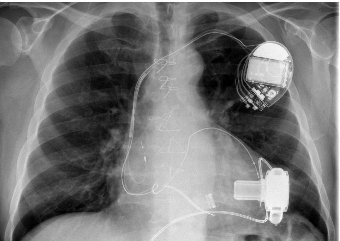 eb4bdc62e5308acf9119079e2bf12bfe-sz_7493