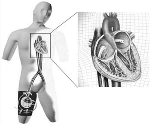 8a84dfa18187f74a71520a1ff53d6b69-sz_2211