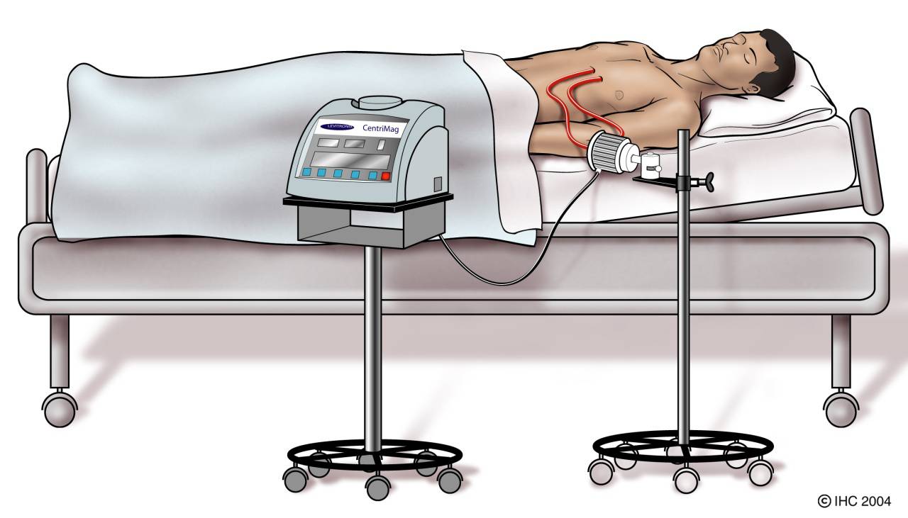 cd096287455c7061a3c4eec890b5a619-sz_7552