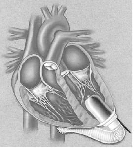 59e3b586f9a5e1220cc67bc8bb1dfd99-sz_1318