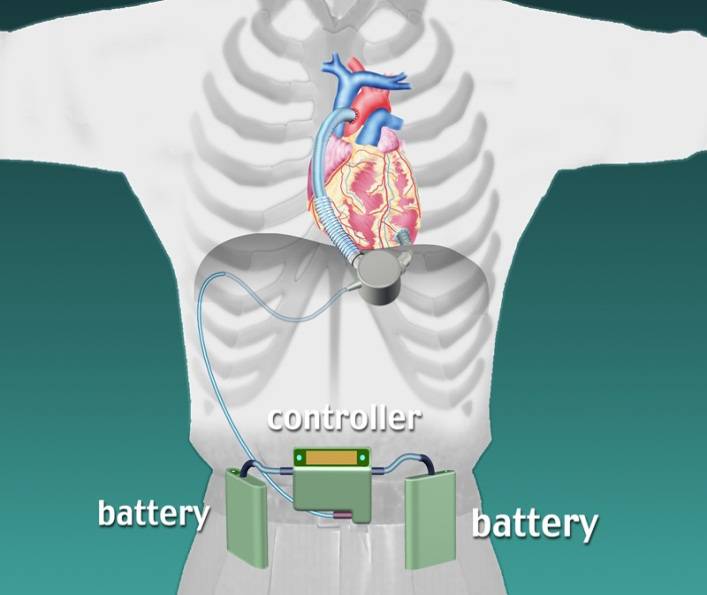 c25d06c51ba68370886496dbd074d8db-sz_2956