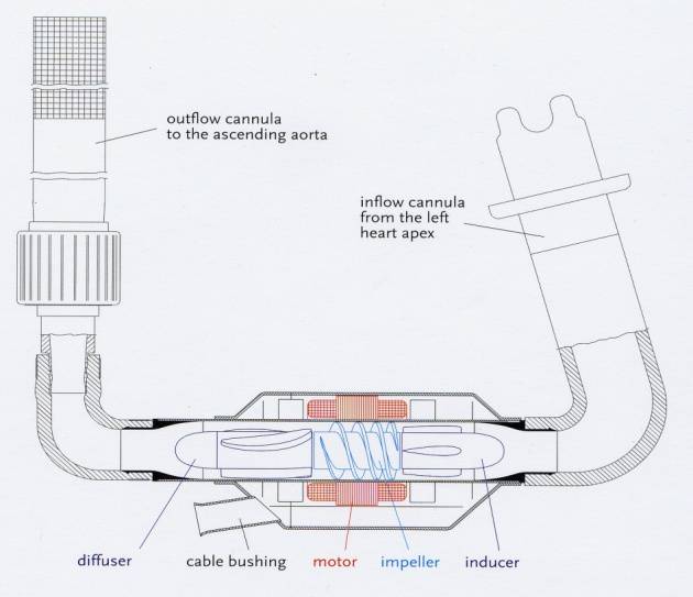 b80bedc95fc2728c03458c184a6a0454-sz_2911