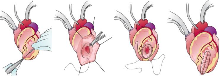 1a263101dc2edfacc85b6a173c02ecf0-sz_2498