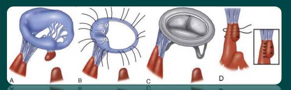 5fd2f45144d72a68d5ea9dfd209d9f53-sz_1673